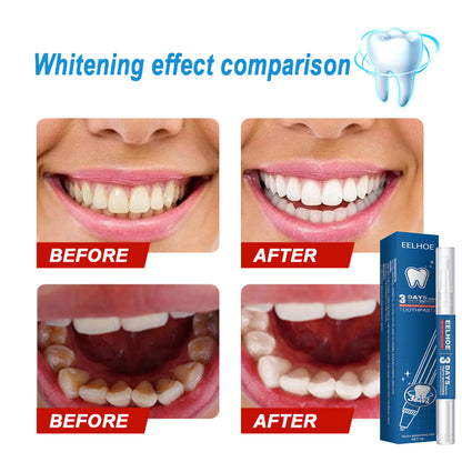 EELHOE Teeth Whitening Pen for Stain Removal and Care