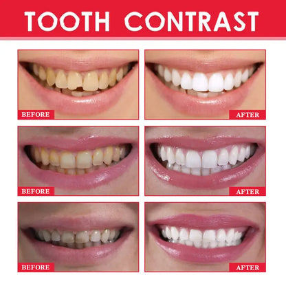 Tooth Whitening Essence for Stains and Fresh Breath